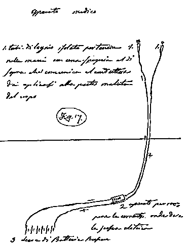 Layout of medical apparatus used by Antonio Meucci for electrotherapy